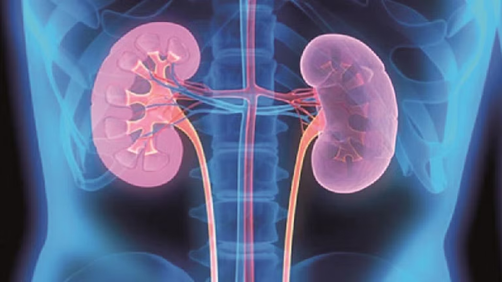 Kidney failure is a growing concern, reveals study