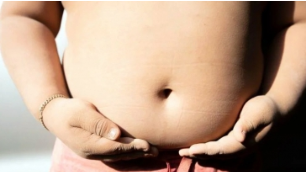 Childhood obesity in India likely to rise 9.1% annually by 2035