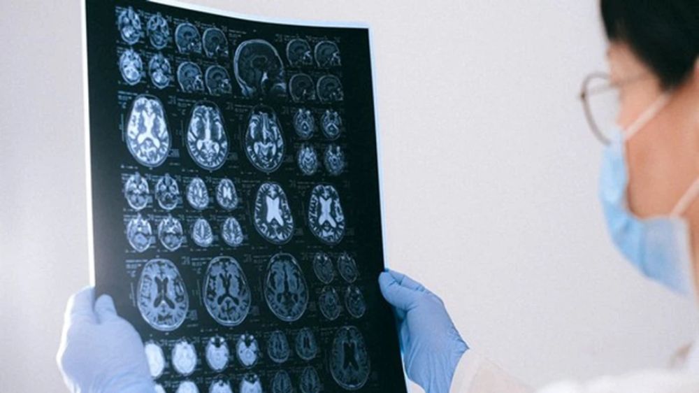 Study suggests how cancer spreads to the brain