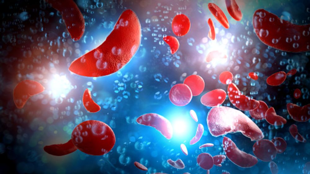 City hospital helps hypo anaemic patient recover