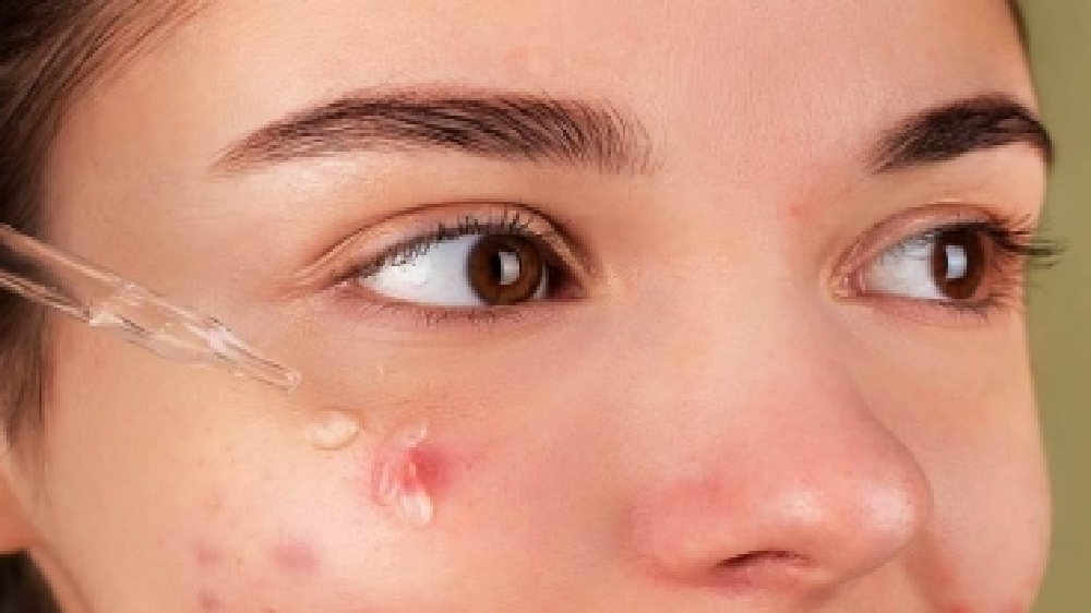 What causes warts and how to get rid of them? What causes warts and how to get rid of them?