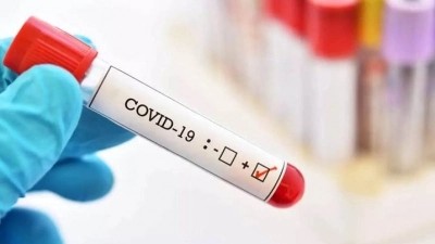 New method for early detection of SARS-CoV-2 infection