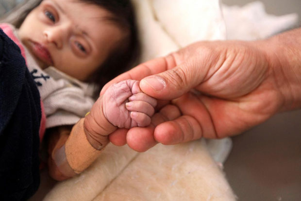 Yemen food survey finds majority in dire crisis, famine a danger