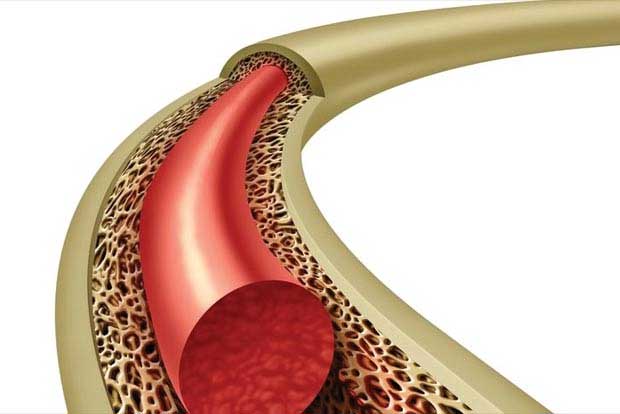 Thanjavur child survives critical bone marrow transplant