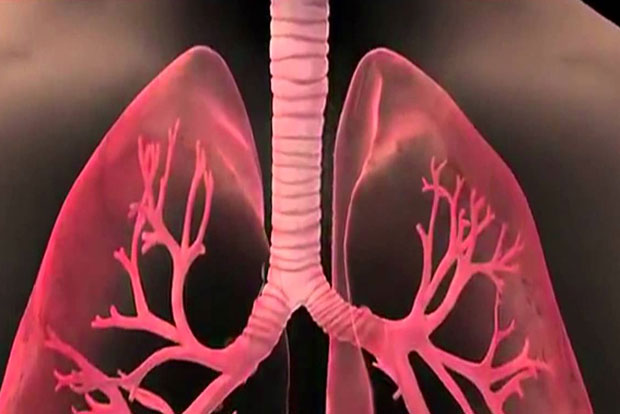 Ask the Doctor: Pollutants in air pollution can bring cancer to people below 40 years