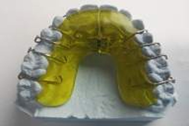 Human teeth used as pendants in Turkey 8,500 years ago