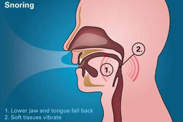 Ask the Doctor: ‘Consult specialist to tide over problem of snoring’