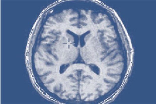 Delhi hospital undertakes study on intercessory prayers effect on brain injury patients