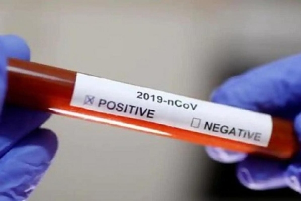 COVID-19: Andhra cases 572, to deploy 1 lakh rapid test kits COVID-19: Andhra cases 572, to deploy 1 lakh rapid test kits