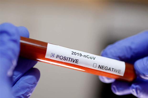 Global COVID-19 cases tops 20.5mn: Johns Hopkins