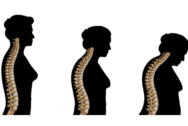 All you need to know about bone health