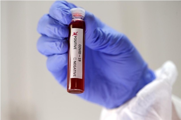 Japan researchers say ozone effective in neutralising coronavirus