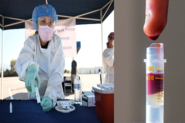 Covid research hits a wall: Why antibody tests won’t help us much