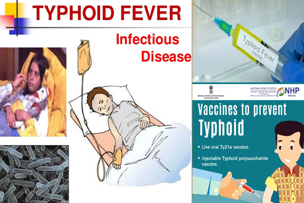 Awareness about typhoid, its prevalence remains low in city: Study