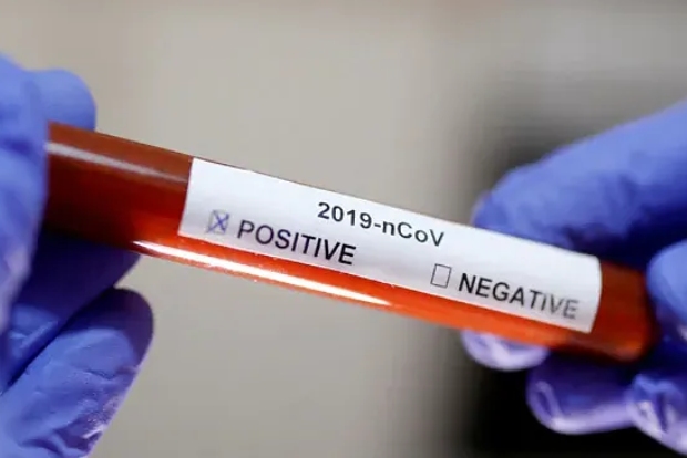 For young people, Covid spells more threat for parents than themselves