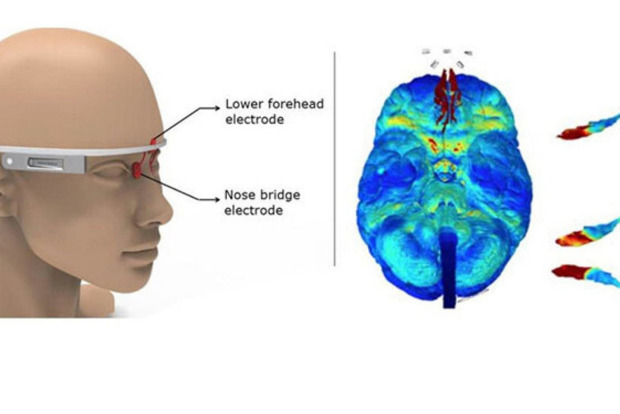 Google Glass-like device could zap Alzheimers disease Google Glass-like device could zap Alzheimers disease