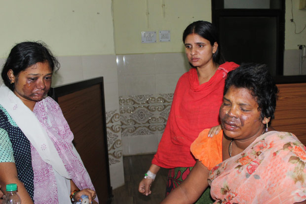 ‘Honour’ assualt: Man smears chemical on pregnant daughter’s face ‘Honour’ assualt: Man smears chemical on pregnant daughter’s face