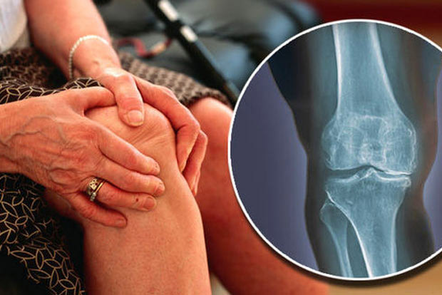69-yr-old undergoes novel procedure for osteoarthritis