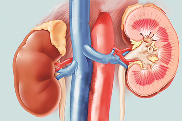 Mediterranean diet may help kidney patients post transplant Mediterranean diet may help kidney patients post transplant
