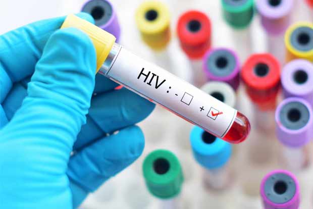 HIV patients lose smallpox immunity despite vaccine: Study
