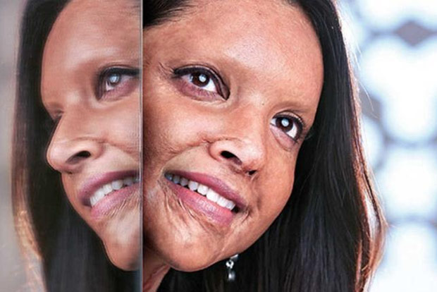 Films like Chhapaak inspire acid victims to live again: Soni Films like Chhapaak inspire acid victims to live again: Soni