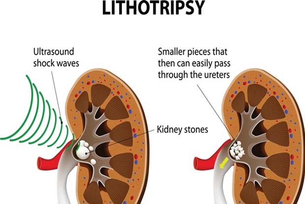 Ask the Doctor: Invisible aligners are more versatile for usage than conventional braces
