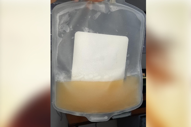 COVID patient cured by plasma therapy in Ktaka: Minister