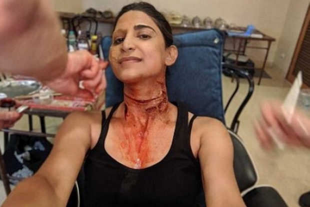 Aahana Kumra on wearing prosthetics in Betaal