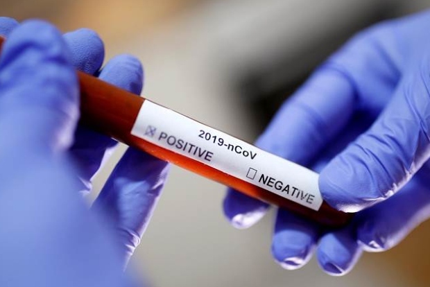 Corpn deploys DHOs for intense virus fight Corpn deploys DHOs for intense virus fight