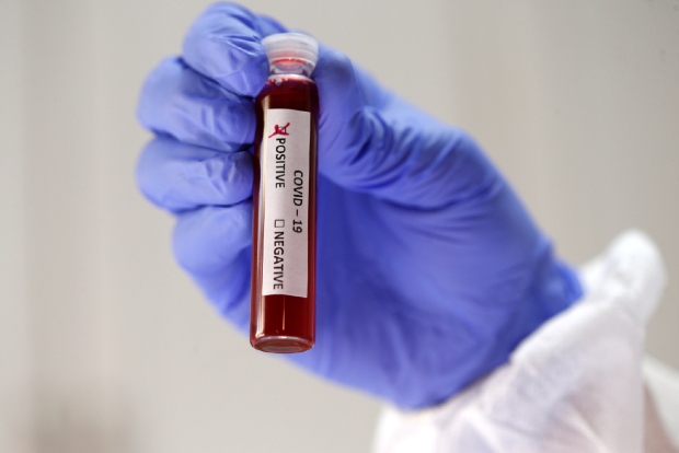 Covid-19 test now available on Practo for Rs 4,500