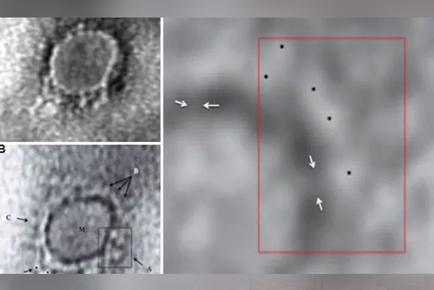 First electron microscope images of Covid-19 virus in India released First electron microscope images of Covid-19 virus in India released