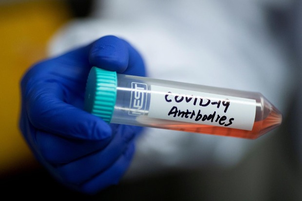 Texas A and M starts human trial of TB vaccine to fight COVID-19