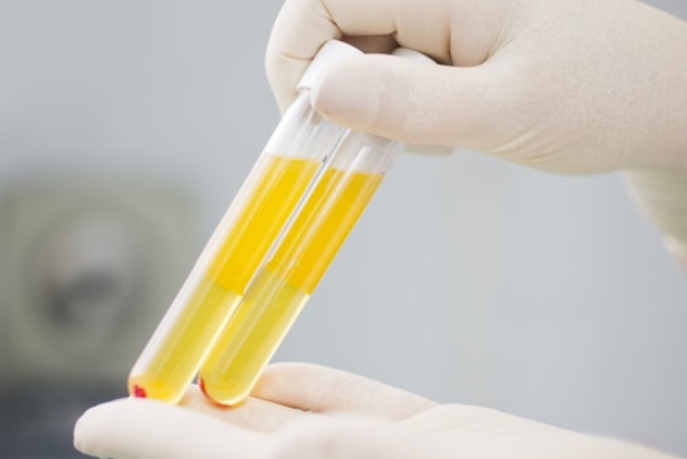 ICMR gets approval for COVID-19 plasma therapy