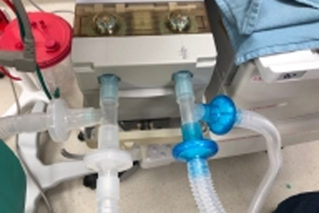 Brakes India gears up to make ventilators to fight Covid-19 Brakes India gears up to make ventilators to fight Covid-19