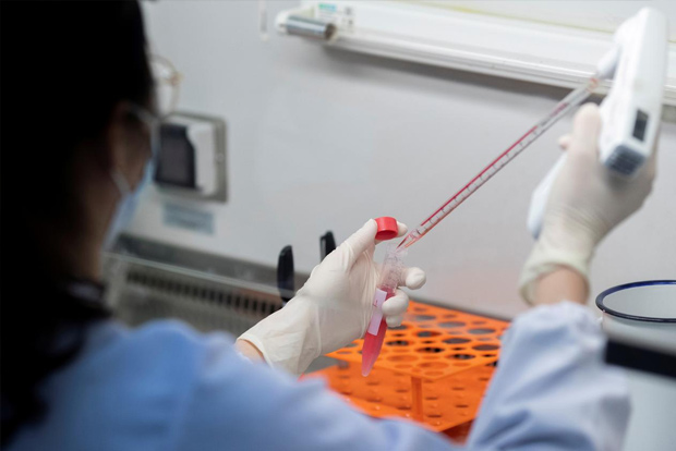 SARS antibody found to neutralise COVID-19 virus SARS antibody found to neutralise COVID-19 virus