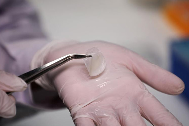 Vitamin B3 can protect skin cells from UV-induced skin cancer