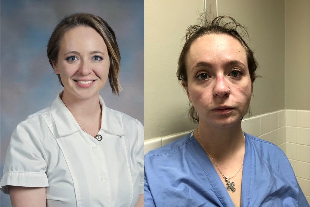 Nurse in the US shares pictures to show toll of treating Covid Nurse in the US shares pictures to show toll of treating Covid