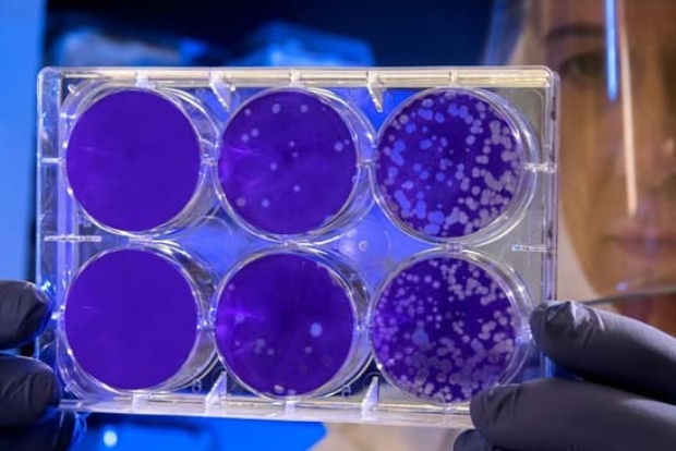 Eating turkey, probiotics may treat people with celiac disease