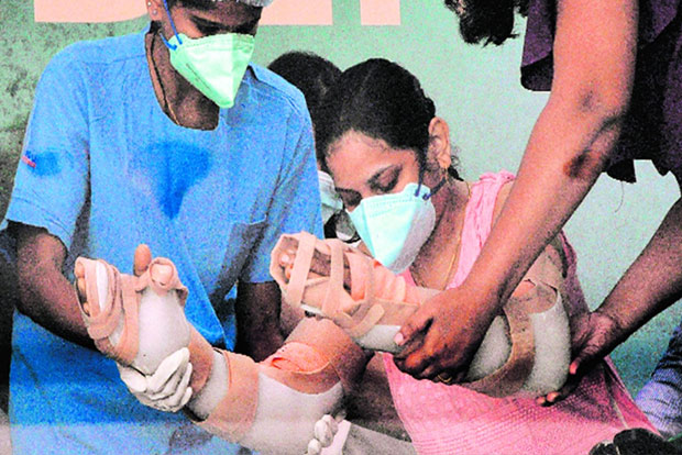 Train accident victim in Mumbai finds hand donor in Chennai Train accident victim in Mumbai finds hand donor in Chennai