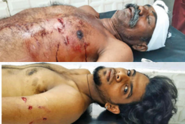 Two hurt in suspected leopard attack in Thuraiyur Two hurt in suspected leopard attack in Thuraiyur