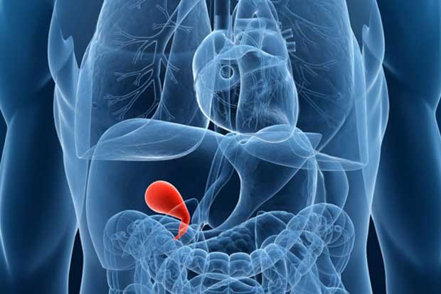 Delay in medical attention leads to more cases of gallbladder issues