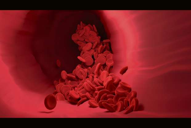 Blood clotting may be behind long Covid syndrome: Study Blood clotting may be behind long Covid syndrome: Study