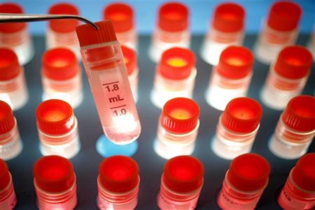 Chennai sees good response in stem cell banking Chennai sees good response in stem cell banking