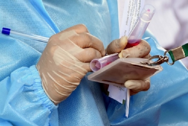 Blood test to track evolution of Covid infection developed