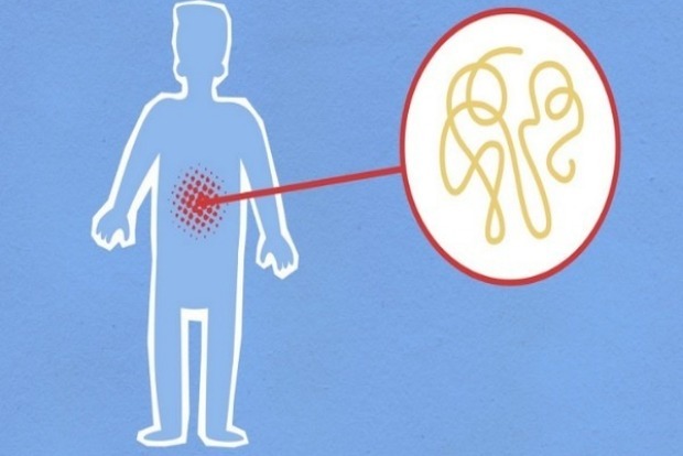 Study finds new way to halt excessive inflammation in body