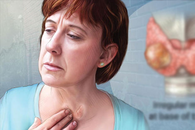 Covid can cause atypical thyroid inflammation: Study