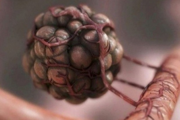 Gallbladder, biliary tract cancer cases up 76 pc in 3 decades