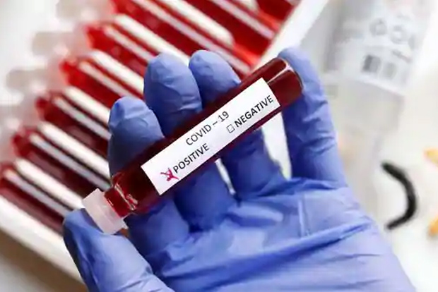 Novel chip that improves testing, tracing for Covid Novel chip that improves testing, tracing for Covid