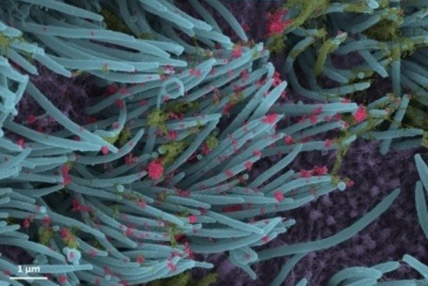 Ultra-low doses of inhaled nanobodies effective against Covid Ultra-low doses of inhaled nanobodies effective against Covid