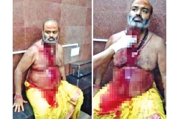 Old image of wounded priest shared with false claim